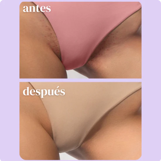 Loción después del afeitado
